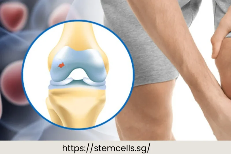 Advanced Stem Cell Therapy in Singapore – Transforming Knee Joint Recovery