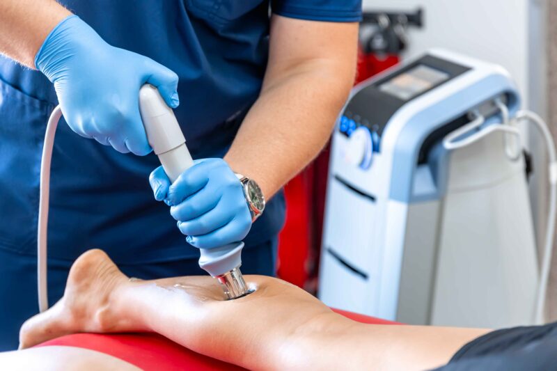 Shockwave Therapy for Plantar Fasciitis: The Breakthrough 2025 Treatment You Haven’t Tried Yet