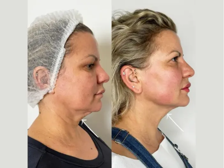Best Aesthetic Clinic in Dubai: Celebrity-Approved Treatments