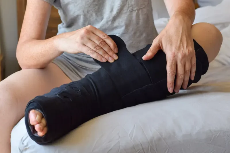 Effective Lymphedema Management: Comfort, Compression, and Confidence with Befitting You Medical Supply