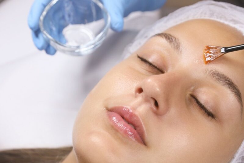 Chemical Peels in Dubai: The Secret to Flawless, Radiant Skin