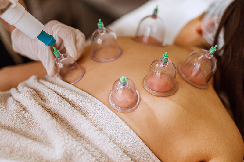 Best Cupping Therapy in Mumbai: Ancient Healing for Modern Wellness