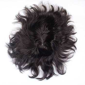 Hair Transplant London – Why Men Are Choosing Modern Hair Restoration Over Waiting for “Someday”