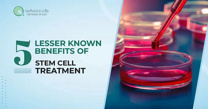 Five Lesser Known Benefits of Stem Cell Treatment