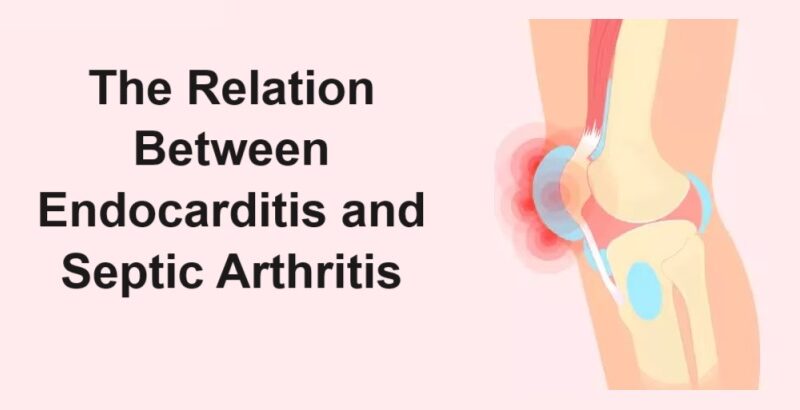 The Relation Between Endocarditis and Septic Arthritis