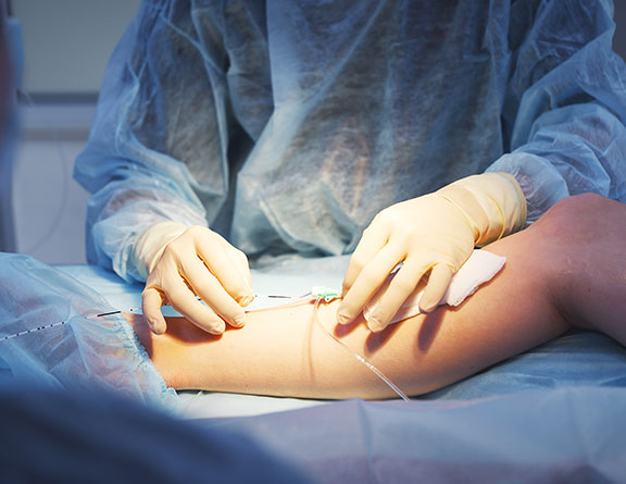 What Are the Most Effective Vein Treatments Available in New Jersey?