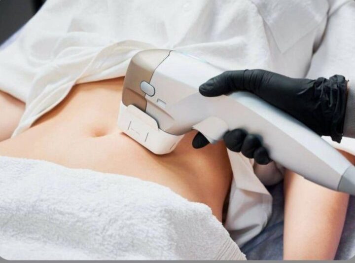 5 Things to Consider Before Undergoing Body Contouring Treatments