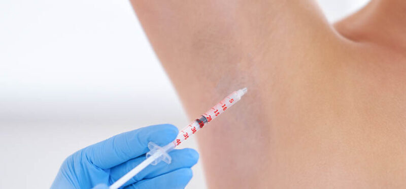 Advanced Care for Excessive Sweating with Botox