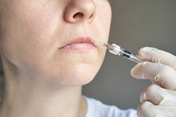 Are Russian Lip Fillers Right for You?