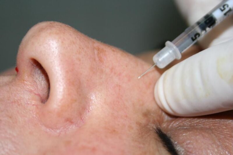 Botox Nose Treatment Designed for Natural Results