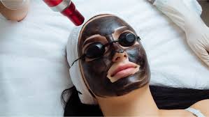 Clearer Skin Starts with Laser Carbon Peel