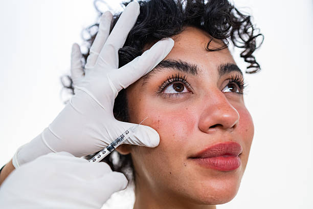 Do Under Eye Fillers Reduce Dark Circles?