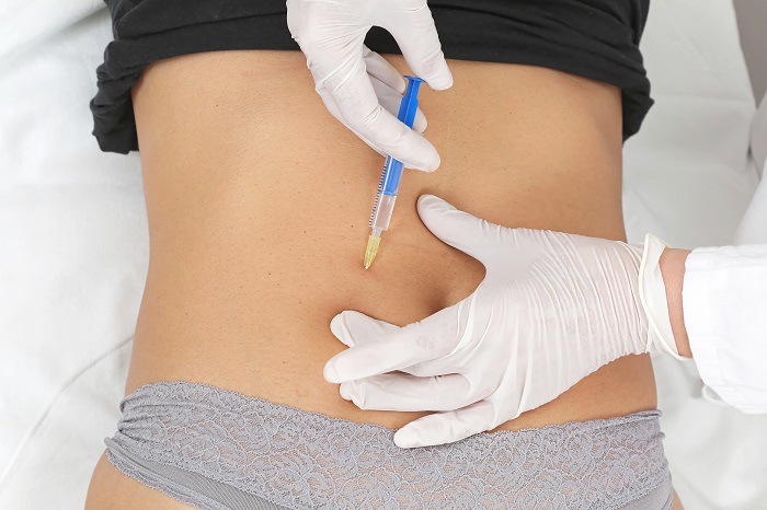 Fat Reduction Without Surgery Injection‑Based Treatments