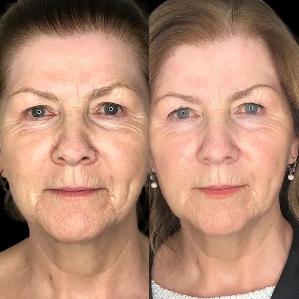 Best Plastic Surgeon in dubai