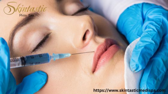 Lip Fillers Riverside