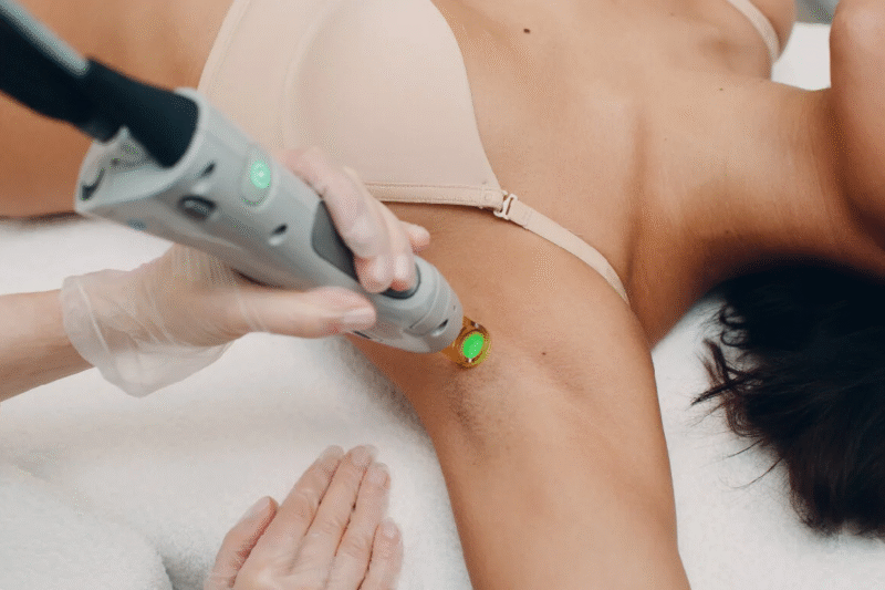 Is Electrolysis Hair Removal Worth the Sessions