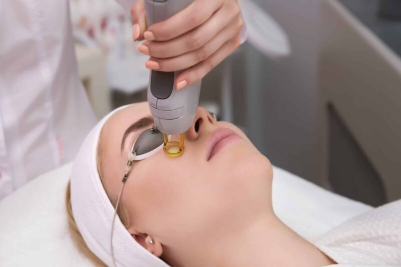 Which Type of Laser Face Treatment is Right for You?