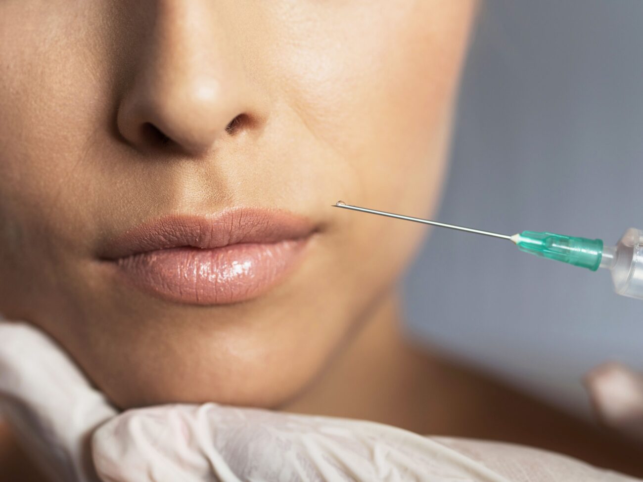 Lip Augmentation for a Youthful and Elegant Appearance