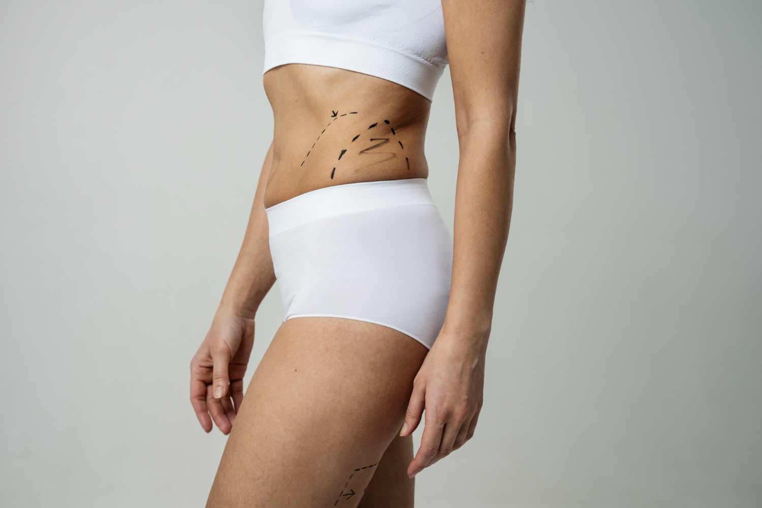 Expert Care by the Best Liposuction Surgeon in Dubai