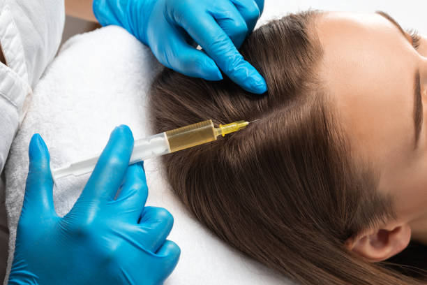 What PRP Hair Injections Do for Thinning Hair?