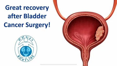 Urosuppliments Explained: Doctors Reveal the Benefits You Shouldn’t Ignore