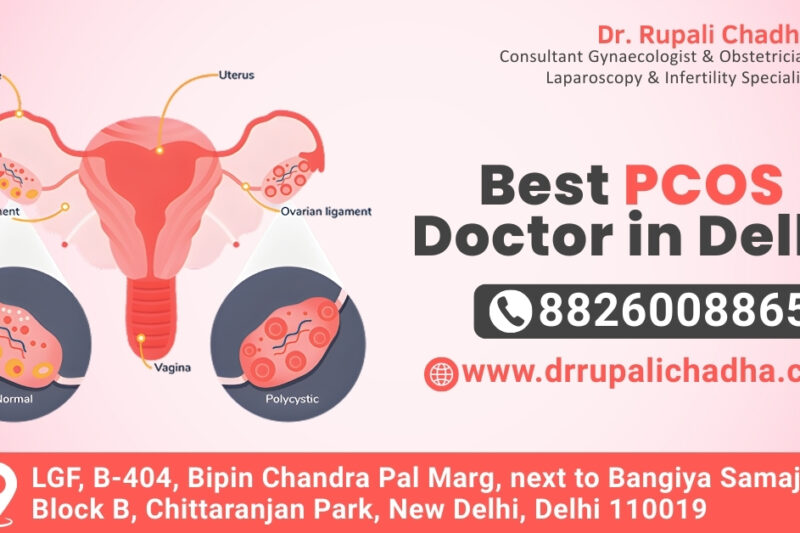 Best PCOS Doctor in Delhi for Teens and Young Women: Dr. Rupali Chadha
