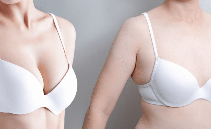 How Does Breast Augmentation in Dubai Highlight Your Unique Glow?