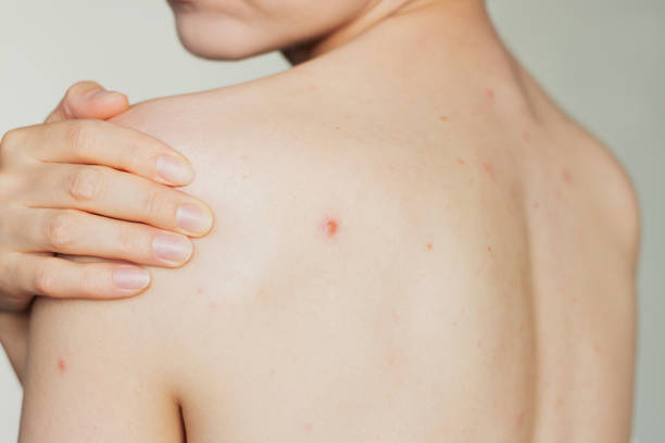 Can Skin Diseases Treatment Reduce Skin Inflammation?