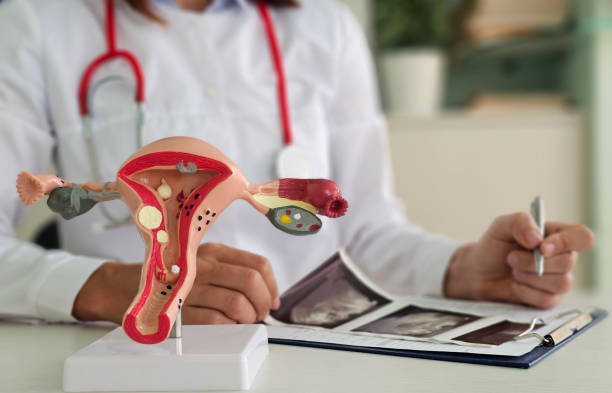 Can a Gynecologist Treat Recurrent Yeast Infections