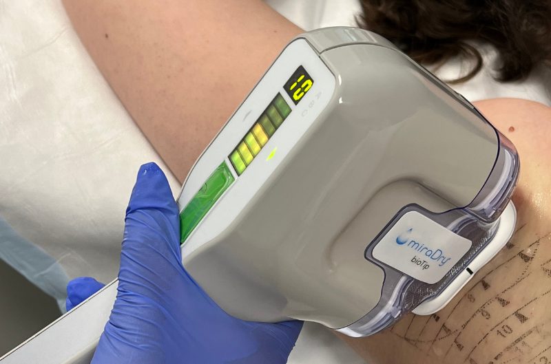 Control Excessive Sweating with Modern Treatments