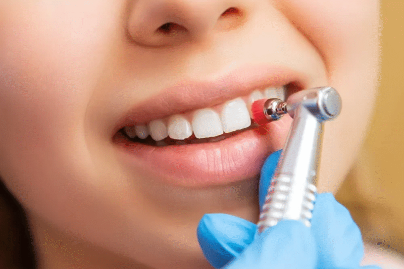 Does Teeth Cleaning Remove All Plaque and Tartar?