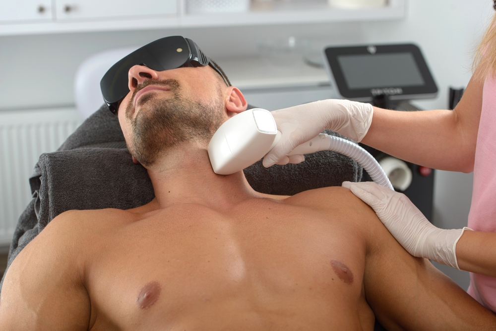 Dose Beard Laser Hair Removal Leave Marks