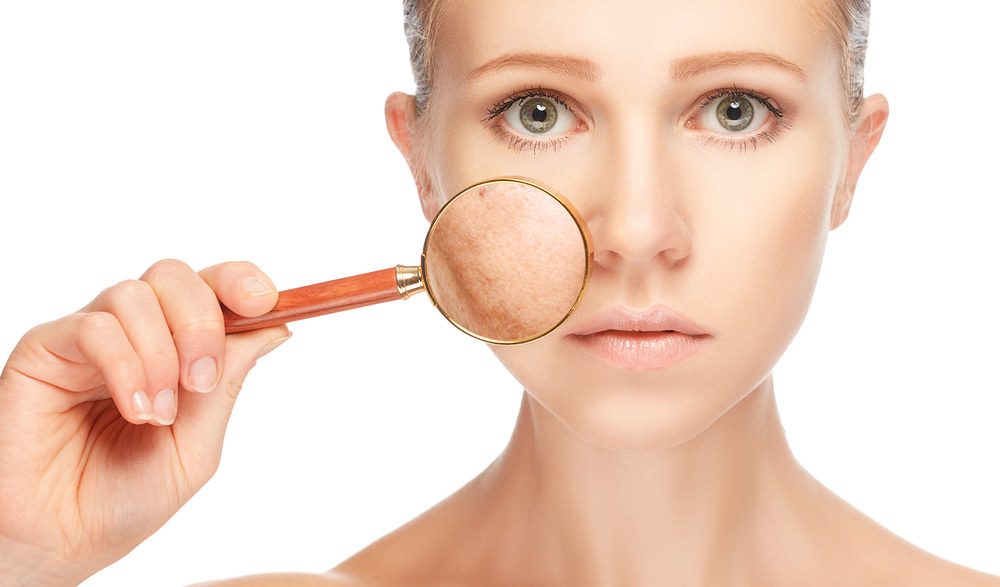 Dose Pigmentation Treatment Reduce Acne Marks