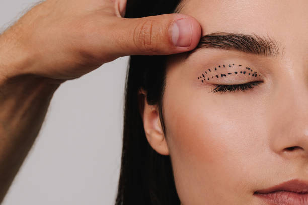 Eyelid Surgery Guide to Beginner’s for Fresh Looks