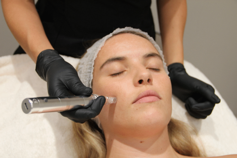 How Dermapen Helps Repair Damaged Skin