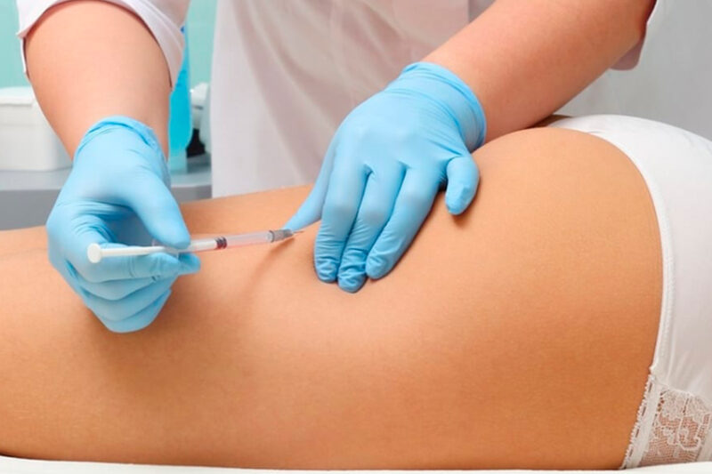 How Do Butt Fillers Enhance Confidence?