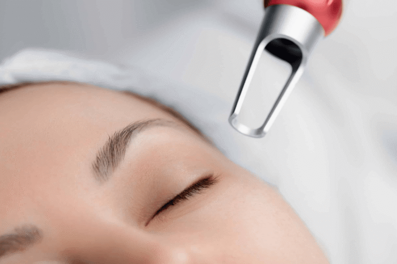 How Safe Is Pico Laser Treatment for Face