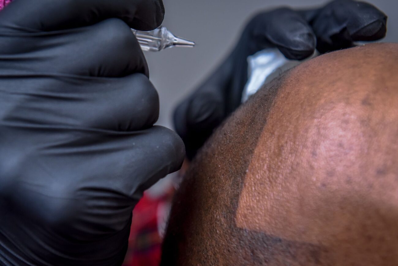 How Scalp Micropigmentation Boosts Confidence