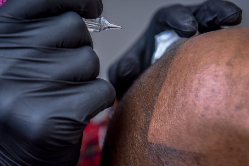 How Scalp Micropigmentation Boosts Confidence