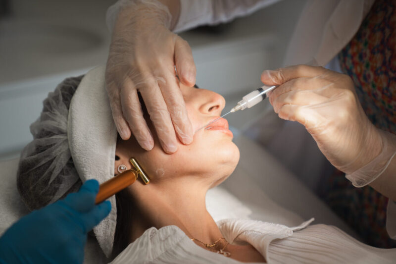 How Sculptra Fillers Improve Skin Quality