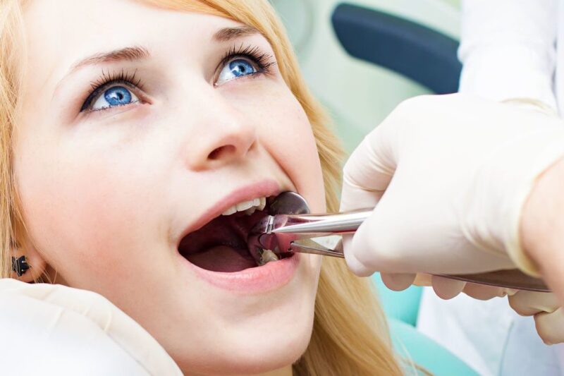 How Soon Can You Eat After Tooth Removal