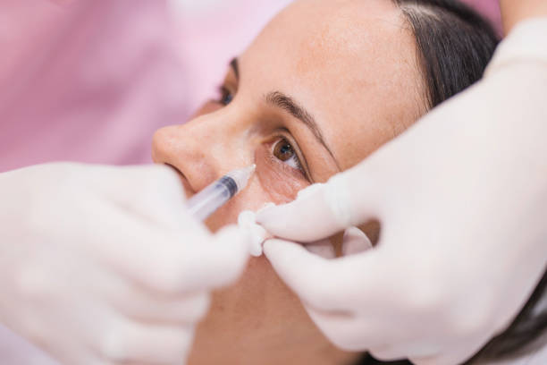 How Under Eye Fillers Enhance Youthful Eyes