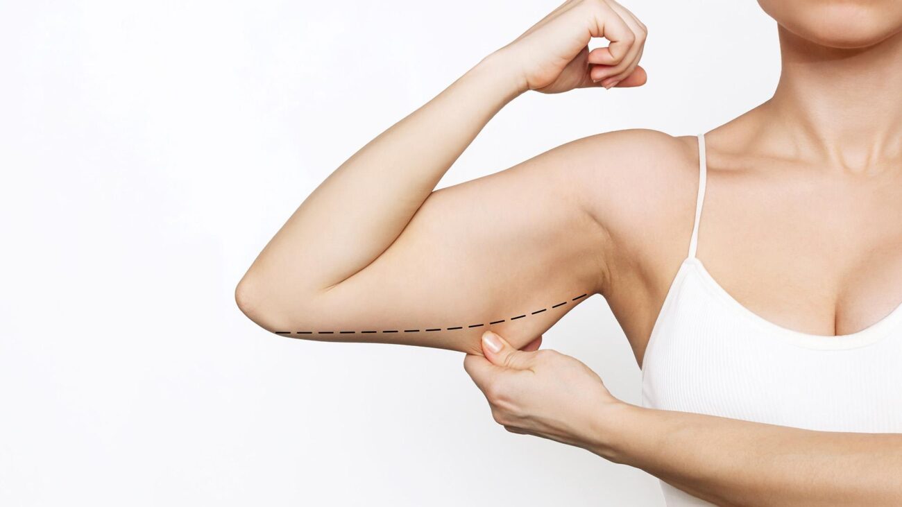 Is Arm Lift Painful or Manageable