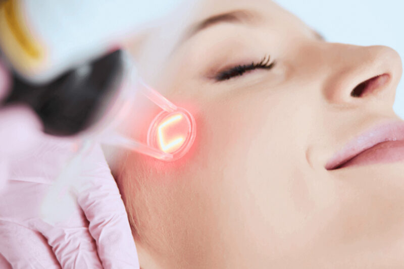 Is Fractional CO2 Painful or Minimally Invasive