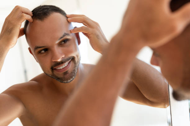 Is Hair Transplant Effective for Bald Patches