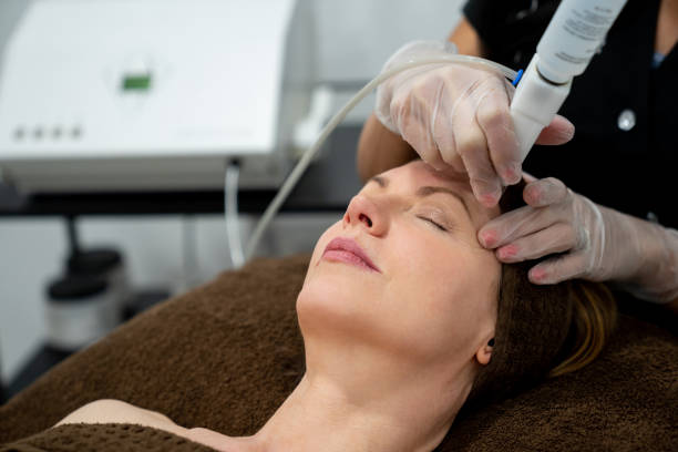 Is Pico Laser Treatment Better Than Traditional Lasers