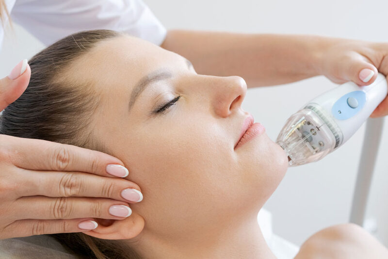 Is RF Microneedling Painful or Comfortable