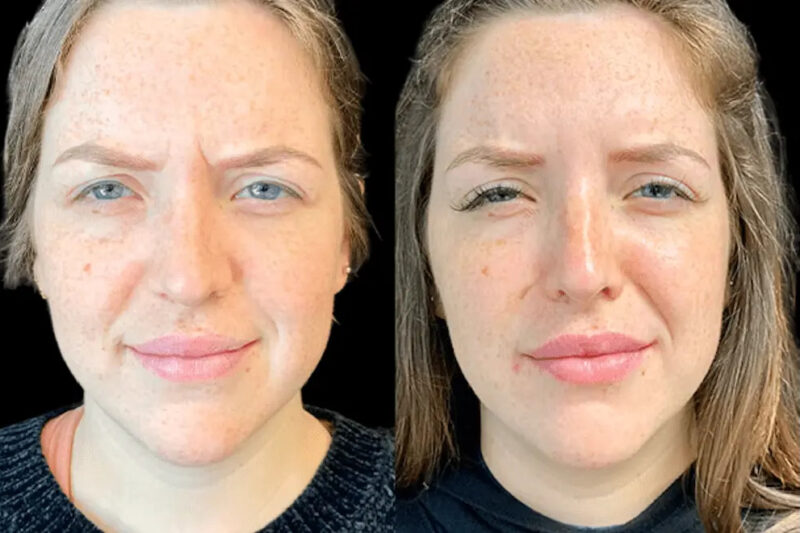 Best Plastic Surgeons in Dubai for Customized Botox Treatment Plans