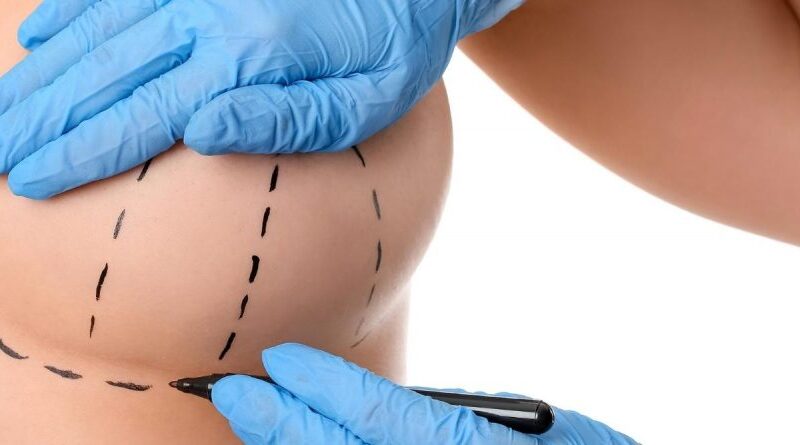 Safe and Advanced Breast Reduction