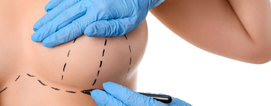 Safe and Advanced Breast Reduction